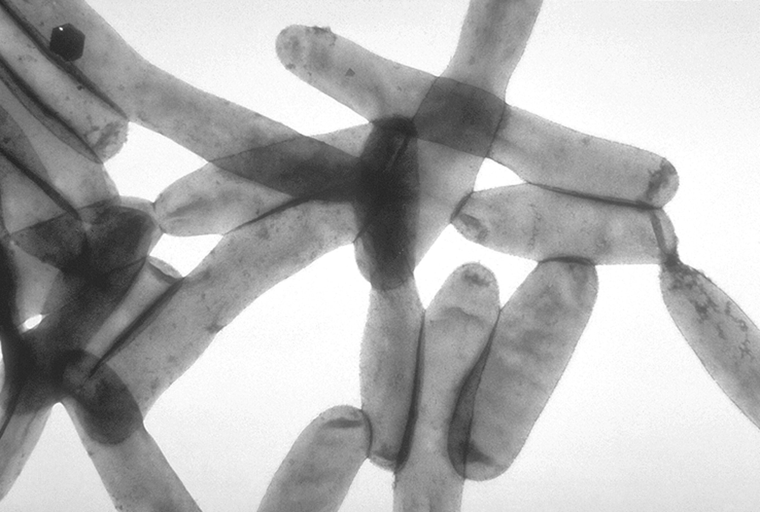 Surto de legionella faz terceira vítima | Dasartes